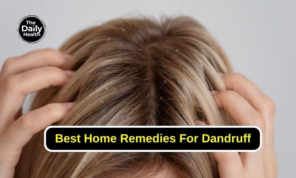 Best Home Remedies For Dandruff