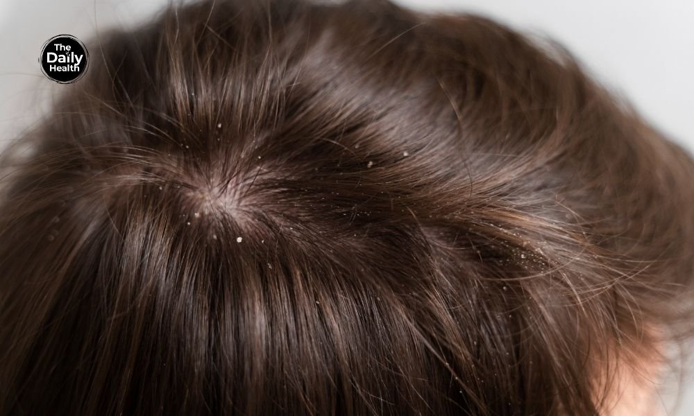 Home 174 Treat Itchy Scalp At Home
